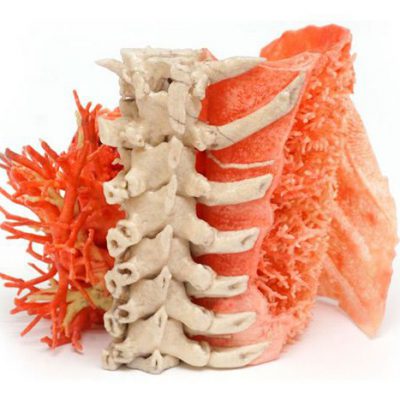 Applications Medical models 3D-Application_Lung2_946-726x560