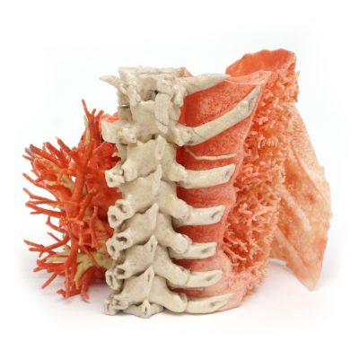 Applications Medical models Lung_2