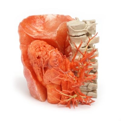 Applications Medical models Lung_3