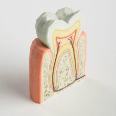 Applications Medical models Tooth