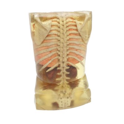 Applications Medical models Torso_back