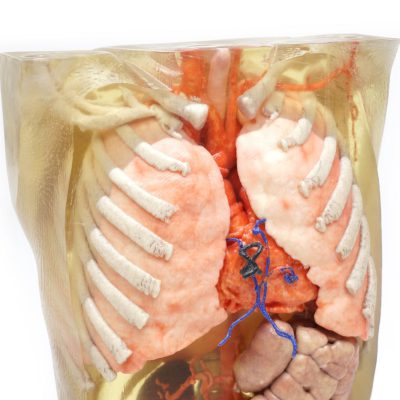 Applications Medical models Torso_close